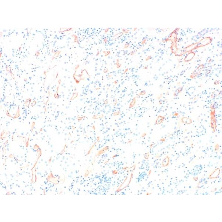Immunohistochemistry - Anti-C4d Antibody (A282705) - Antibodies.com