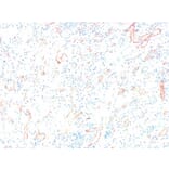 Immunohistochemistry - Anti-C4d Antibody (A282705) - Antibodies.com