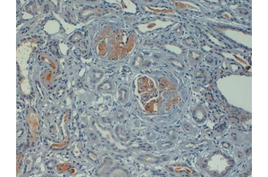 Immunohistochemistry - Anti-C4d Antibody (A282705) - Antibodies.com