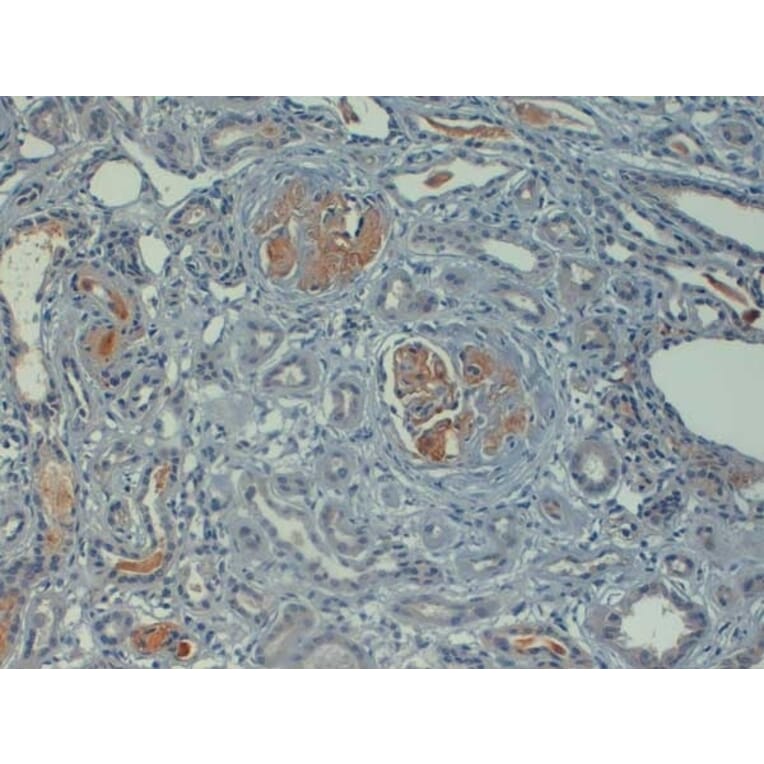 Immunohistochemistry - Anti-C4d Antibody (A282705) - Antibodies.com
