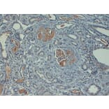 Immunohistochemistry - Anti-C4d Antibody (A282705) - Antibodies.com