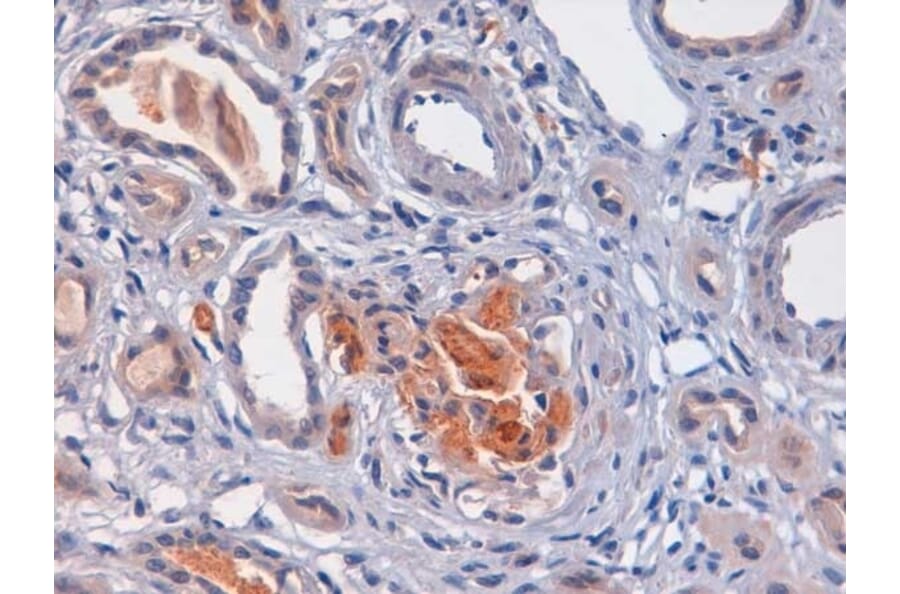 Immunohistochemistry - Anti-C4d Antibody (A282705) - Antibodies.com