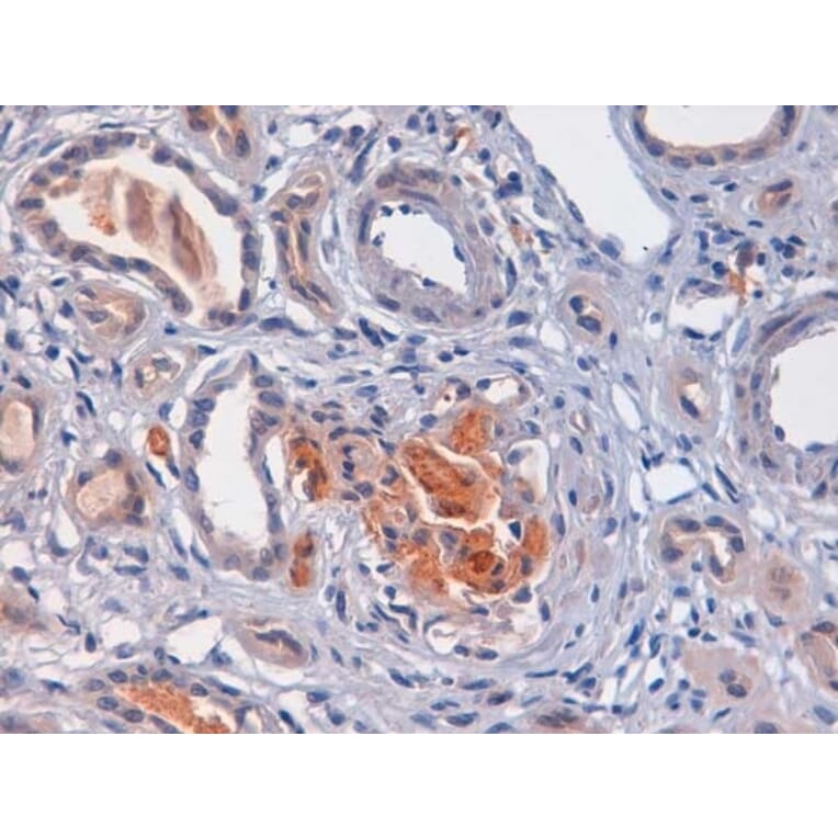 Immunohistochemistry - Anti-C4d Antibody (A282705) - Antibodies.com