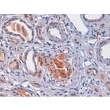 Immunohistochemistry - Anti-C4d Antibody (A282705) - Antibodies.com