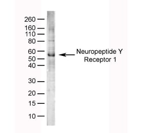 SDS-PAGE - Anti-NPY1R Antibody (A282853) - Antibodies.com