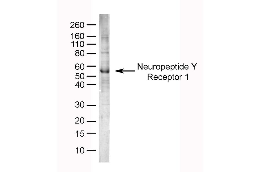SDS-PAGE - Anti-NPY1R Antibody (A282853) - Antibodies.com