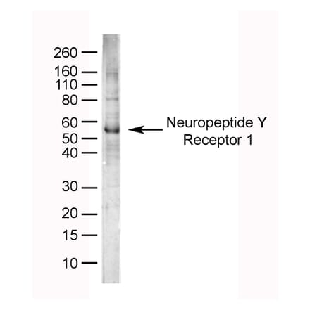 SDS-PAGE - Anti-NPY1R Antibody (A282853) - Antibodies.com