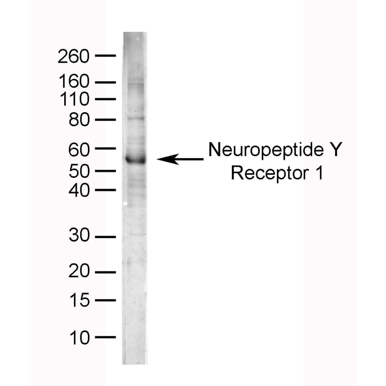 SDS-PAGE - Anti-NPY1R Antibody (A282853) - Antibodies.com