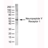 SDS-PAGE - Anti-NPY1R Antibody (A282853) - Antibodies.com
