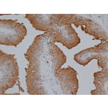 Immunohistochemistry - Anti-Prostate Specific Antigen Antibody (A282871) - Antibodies.com