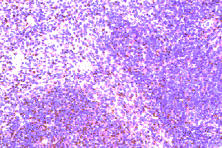 Flow Cytometry - Anti-CCR8 Antibody (A282963) - Antibodies.com