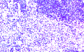 Immunohistochemistry - Anti-CCR7 Antibody (A282964) - Antibodies.com