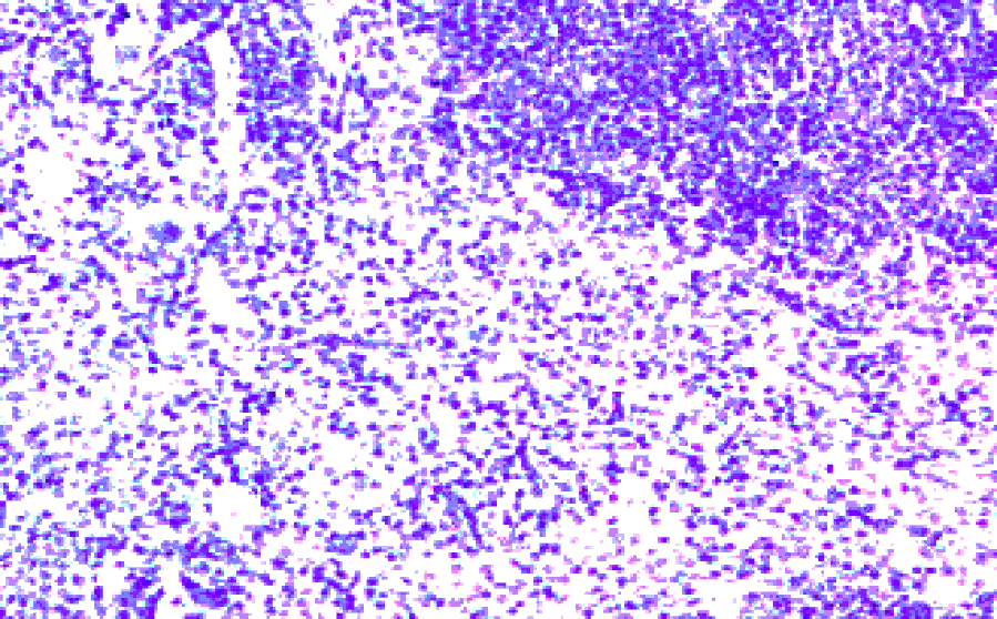 Immunohistochemistry - Anti-CCR7 Antibody (A282964) - Antibodies.com