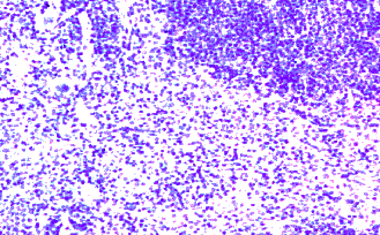 Immunohistochemistry - Anti-CCR7 Antibody (A282964) - Antibodies.com