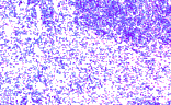 Immunohistochemistry - Anti-CCR7 Antibody (A282964) - Antibodies.com