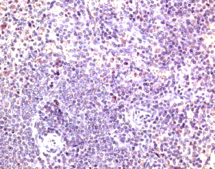 Immunohistochemistry - Anti-CCR7 Antibody (A282964) - Antibodies.com