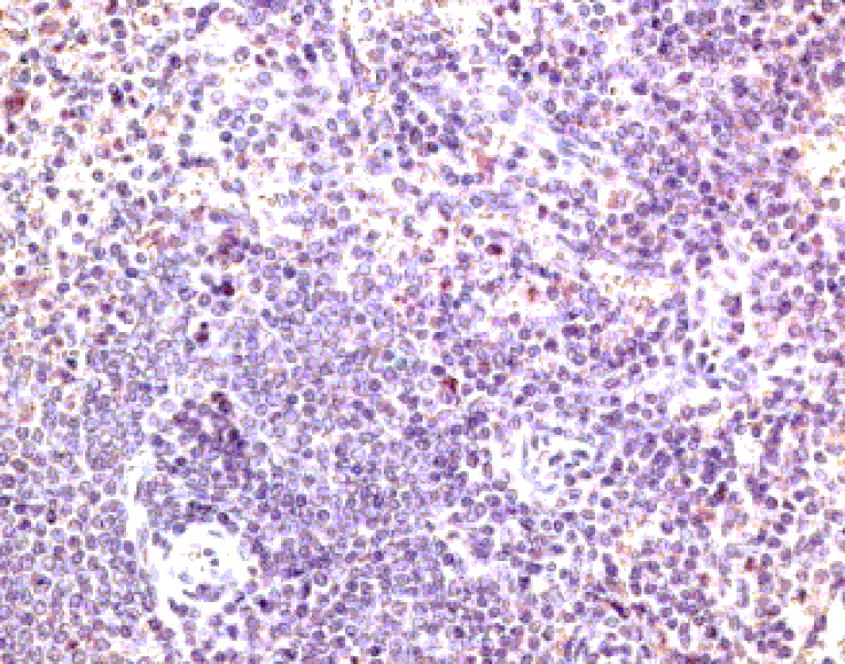 Immunohistochemistry - Anti-CCR7 Antibody (A282964) - Antibodies.com