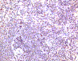 Immunohistochemistry - Anti-CCR7 Antibody (A282964) - Antibodies.com