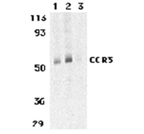 Western Blot - Anti-CCR3 Antibody (A282998) - Antibodies.com