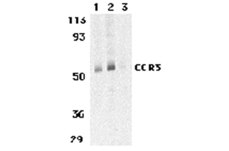 Western Blot - Anti-CCR3 Antibody (A282998) - Antibodies.com