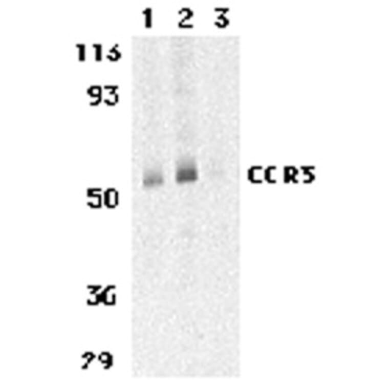 Western Blot - Anti-CCR3 Antibody (A282998) - Antibodies.com