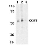 Western Blot - Anti-CCR3 Antibody (A282998) - Antibodies.com