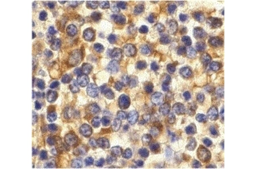 Immunohistochemistry - Anti-CCR3 Antibody (A282998) - Antibodies.com
