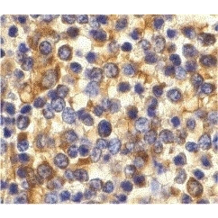 Immunohistochemistry - Anti-CCR3 Antibody (A282998) - Antibodies.com