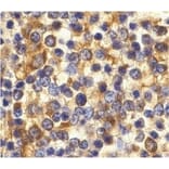 Immunohistochemistry - Anti-CCR3 Antibody (A282998) - Antibodies.com