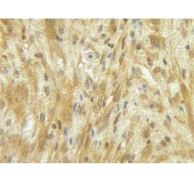Immunohistochemistry - Anti-G-CSF Antibody - BSA and Azide free (A283011) - Antibodies.com