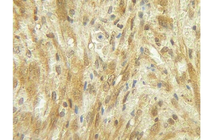 Immunohistochemistry - Anti-G-CSF Antibody - BSA and Azide free (A283011) - Antibodies.com