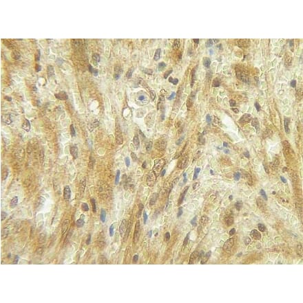 Immunohistochemistry - Anti-G-CSF Antibody - BSA and Azide free (A283011) - Antibodies.com