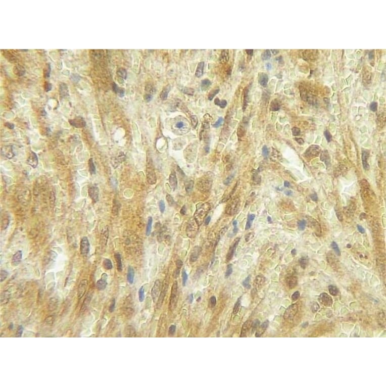 Immunohistochemistry - Anti-G-CSF Antibody - BSA and Azide free (A283011) - Antibodies.com