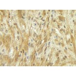 Immunohistochemistry - Anti-G-CSF Antibody - BSA and Azide free (A283011) - Antibodies.com