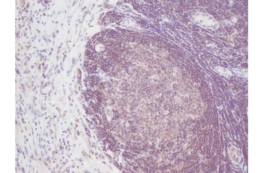 Immunohistochemistry - Anti-IL-2 Antibody - BSA and Azide free (A283012) - Antibodies.com