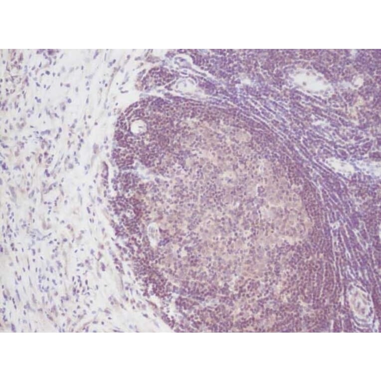 Immunohistochemistry - Anti-IL-2 Antibody - BSA and Azide free (A283012) - Antibodies.com