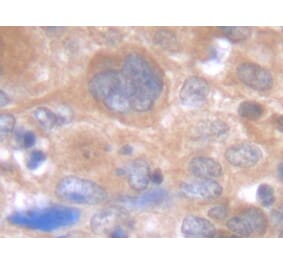 Immunohistochemistry - Anti-IL-6 Antibody - BSA and Azide free (A283015) - Antibodies.com
