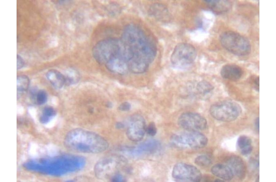 Immunohistochemistry - Anti-IL-6 Antibody - BSA and Azide free (A283015) - Antibodies.com