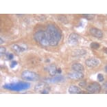 Immunohistochemistry - Anti-IL-6 Antibody - BSA and Azide free (A283015) - Antibodies.com