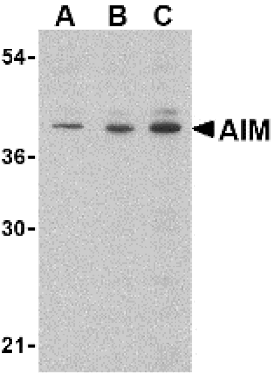 Western Blot - Anti-CD5L / CT-2 Antibody (A283039) - Antibodies.com