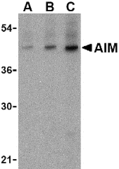 Western Blot - Anti-CD5L / CT-2 Antibody (A283040) - Antibodies.com