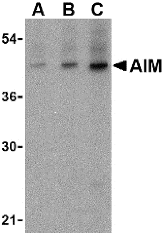 Western Blot - Anti-CD5L / CT-2 Antibody (A283040) - Antibodies.com
