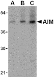 Western Blot - Anti-CD5L / CT-2 Antibody (A283040) - Antibodies.com