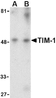 Western Blot - Anti-TIM 1 Antibody (A283057) - Antibodies.com