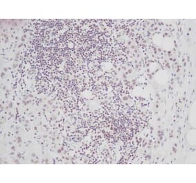 Immunohistochemistry - Anti-CTGF Antibody - BSA and Azide free (A283086) - Antibodies.com