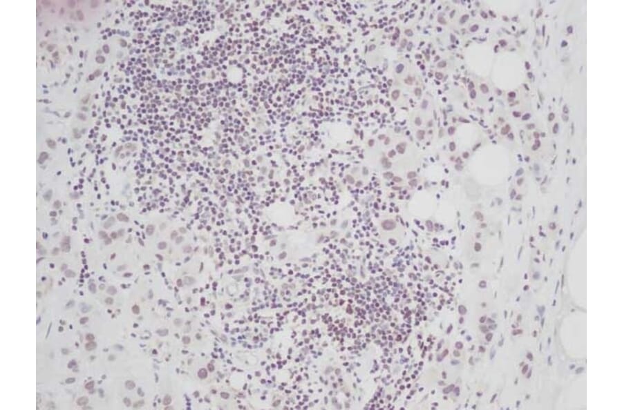 Immunohistochemistry - Anti-CTGF Antibody - BSA and Azide free (A283086) - Antibodies.com