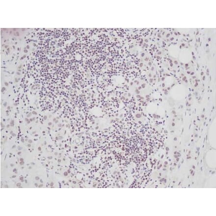 Immunohistochemistry - Anti-CTGF Antibody - BSA and Azide free (A283086) - Antibodies.com
