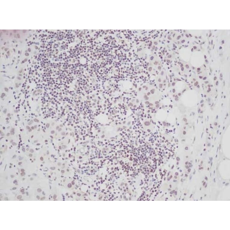 Immunohistochemistry - Anti-CTGF Antibody - BSA and Azide free (A283086) - Antibodies.com