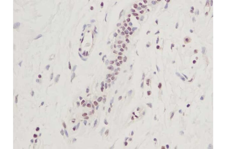 Immunohistochemistry - Anti-CTGF Antibody - BSA and Azide free (A283086) - Antibodies.com