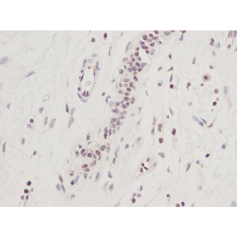 Immunohistochemistry - Anti-CTGF Antibody - BSA and Azide free (A283086) - Antibodies.com